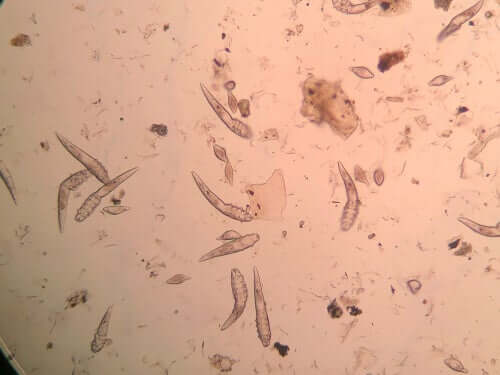 Demodex canis mijten